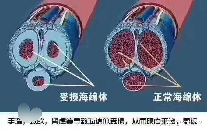 海綿體修復(fù)膏的效果與實(shí)際應(yīng)用探討，海綿體修復(fù)膏效果及實(shí)際應(yīng)用探討