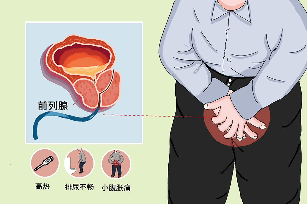 前列腺保健的一般做法，了解、預(yù)防與保護(hù)，前列腺保健指南，了解、預(yù)防與保護(hù)措施